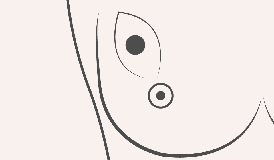 Técnicas de Cirugía Conservadora