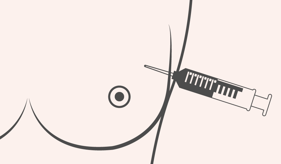 Toma de Biopsias en Mama